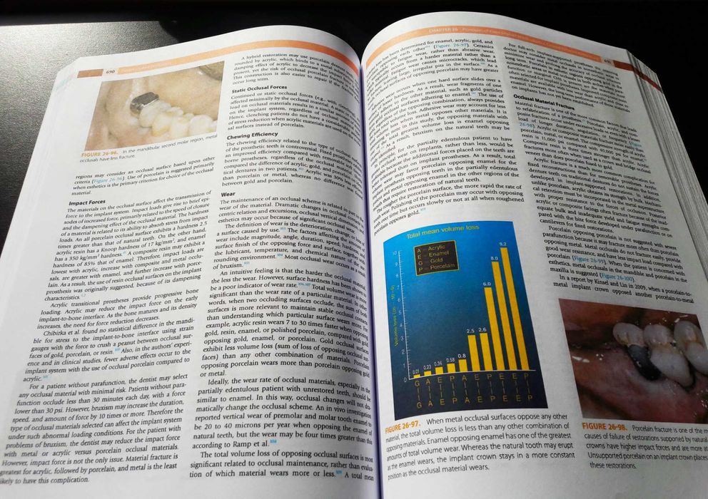 Dental Implant Prosthetics: Carl Misch - (Implantologie protetică)