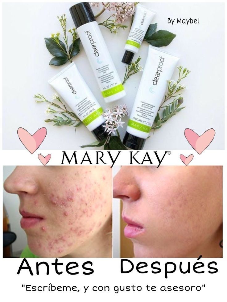 Система для ухода за проблемной кожи Clear Proof ® 18+ Mary Kay