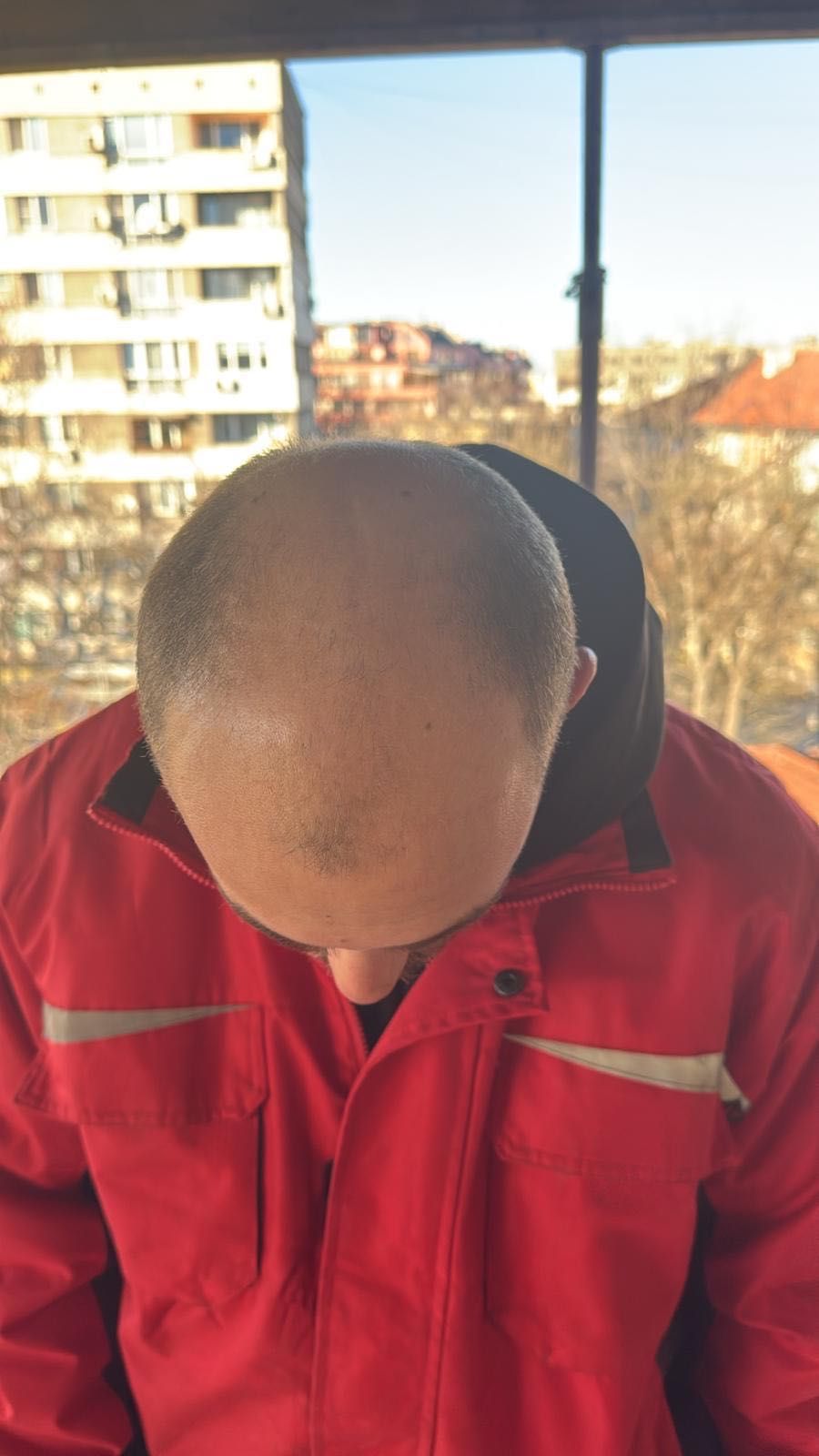 Dermanew Hair грижа за здрава коса
