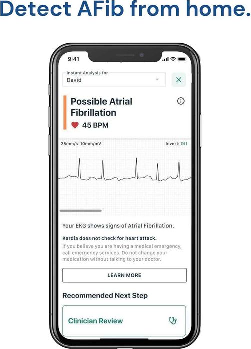 KardiaMobile ЕКГ монитор от AliveCore by OMRON