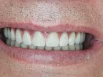 Laborator dentar