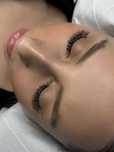 Aplic gene fir cu fir