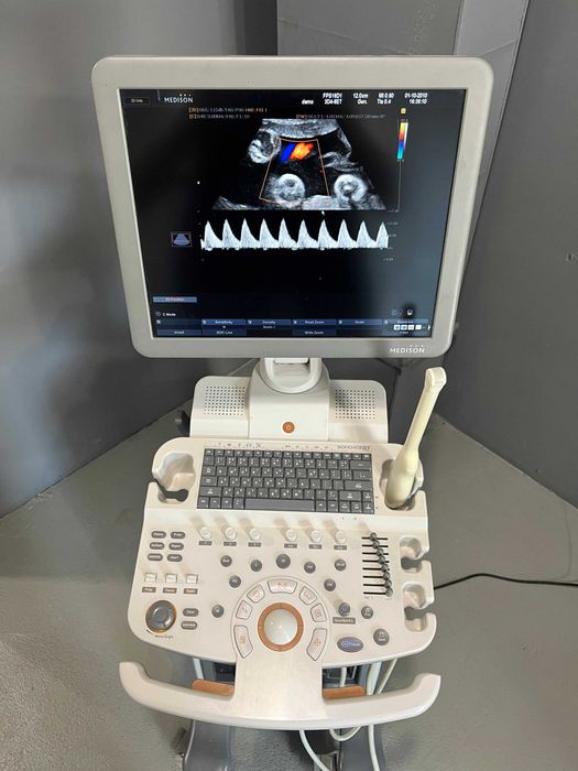 УЗИ аппарат Samsung R7