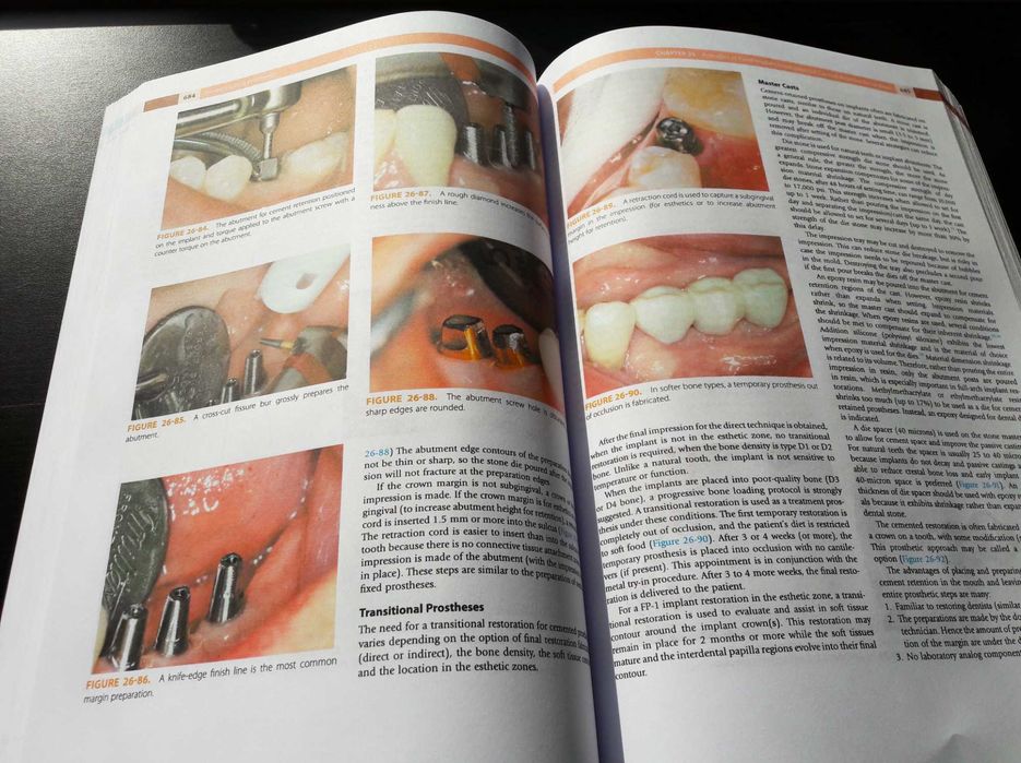 Dental Implant Prosthetics: Carl Misch - (Implantologie protetică)