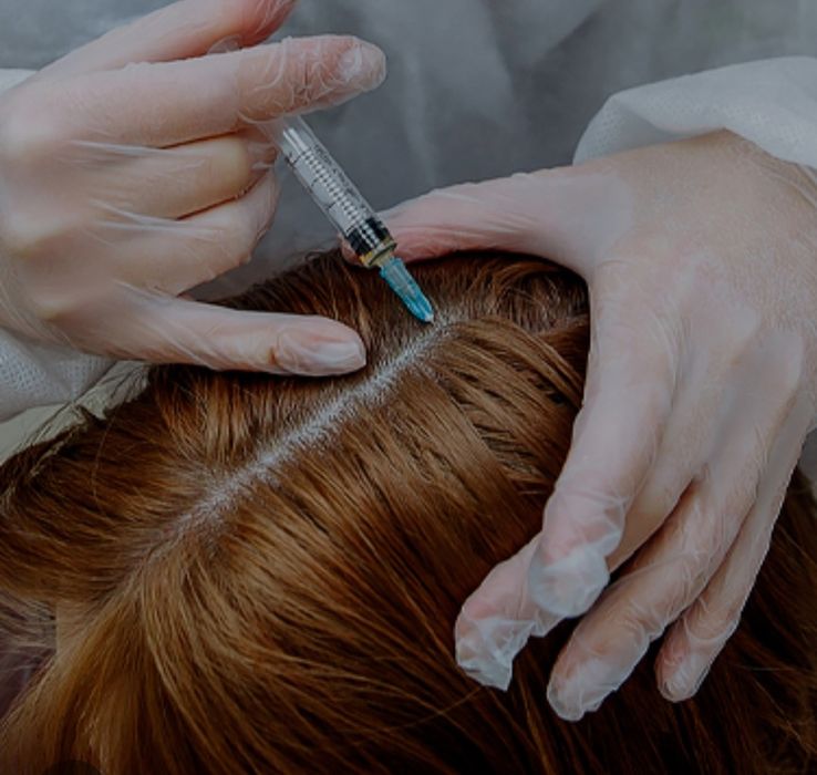 Мезотерапия волос