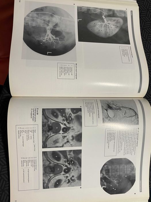 Atlas imagistic de anatomie umana Wolfe medicina rezidentiat impecabil
