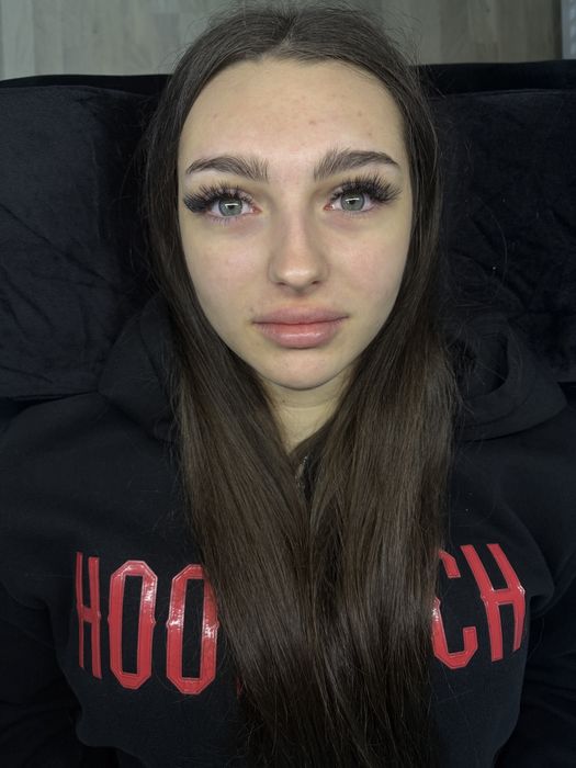 aplic extensii de gene