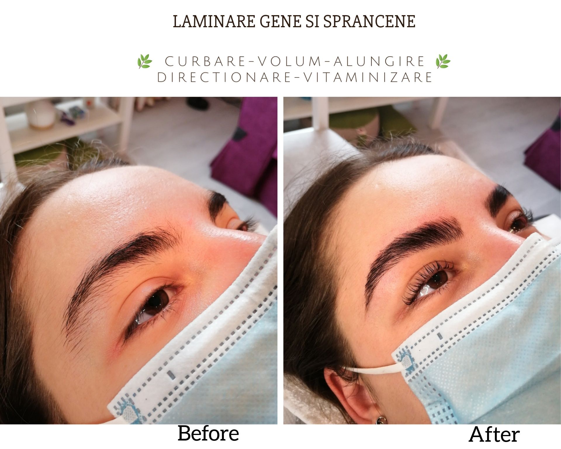 LAMINARE gene/sprancene & PENSAT