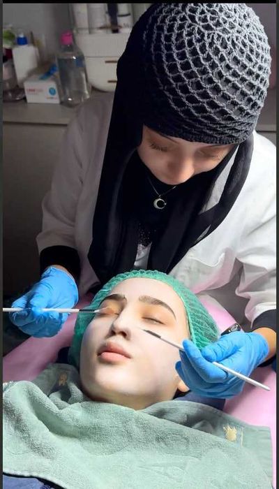 Косметолог Фатима  Чистка лица  Dog‘ va qora nuqtalardan xalos bo‘lish