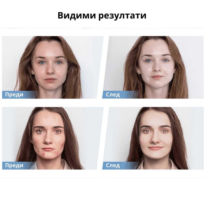 HydraPen H5 от Dr. Pen – микронидлинг и EMS за подмладяване