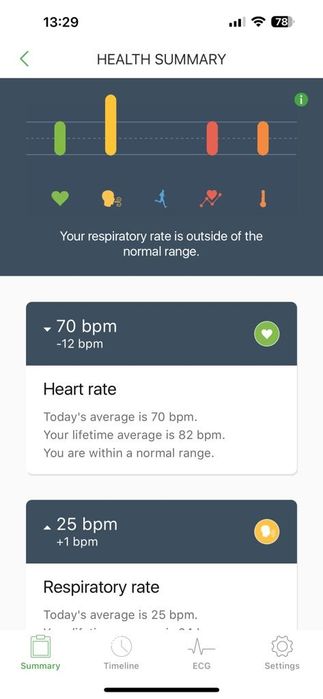Qardio Core monitorizare cardio schimb cu  Garmin Zumo