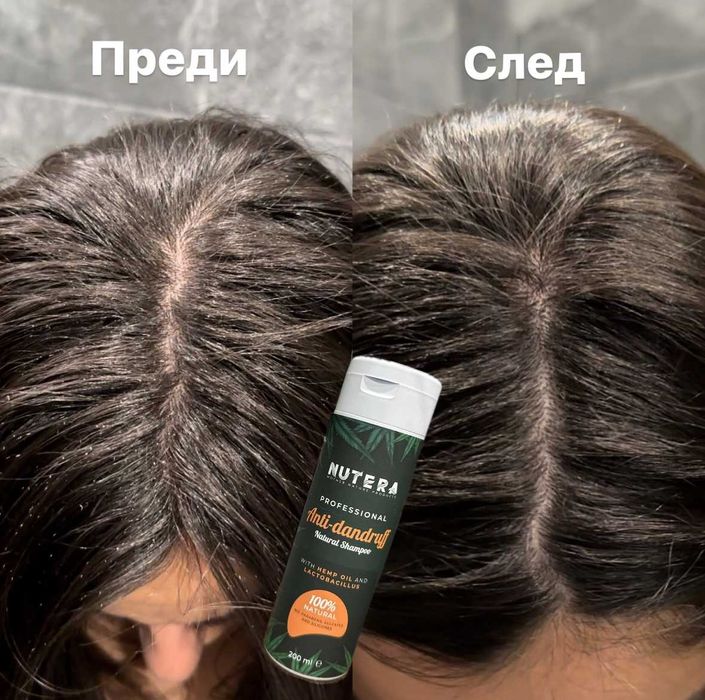 Шампоан против пърхот с конопено масло