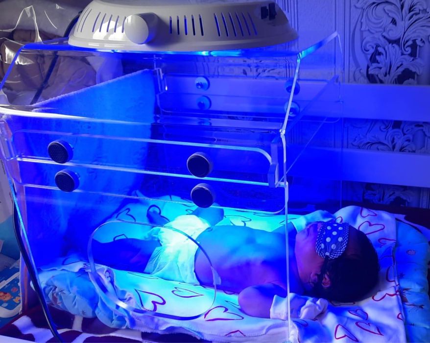 Аренда фотолампы Аксион – эффективное решение для лечения желтушки