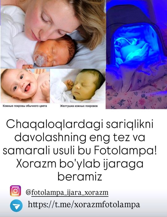 Chaqaloqlar sariqligiga qarshi fotolampa ijarasi