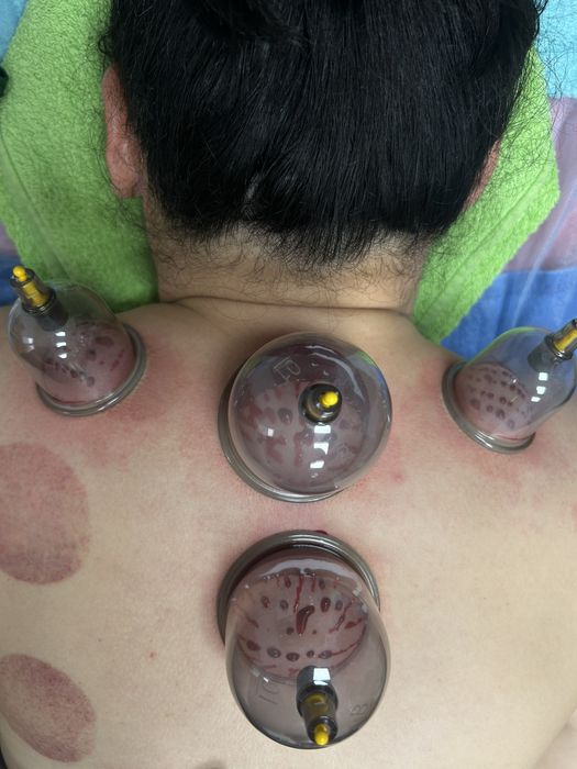 Общий оздоравительный массаж