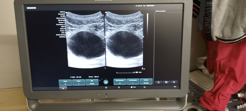 Ecograf Doppler color Siemens