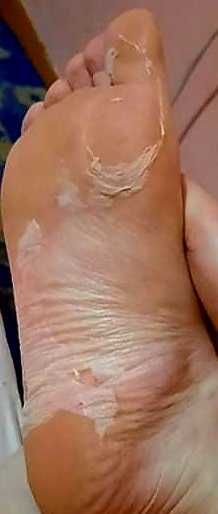 Derma V10 Пилинг и Хидратираща Маска за Крака 2 бр. за 10 лв.