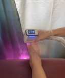 Epilare definitivă laser