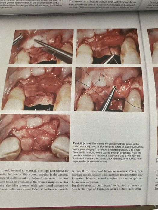 Plastic-Esthetic Periodontal And Implant Surgery- OTTO ZUHR / HURZELER