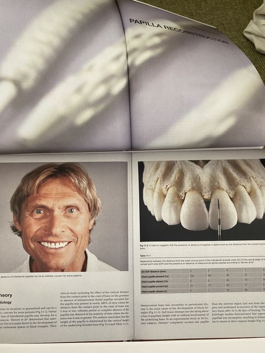 Plastic-Esthetic Periodontal And Implant Surgery- OTTO ZUHR / HURZELER