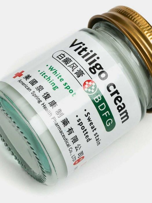Vitiligo kremi oq doglarga qarshi
