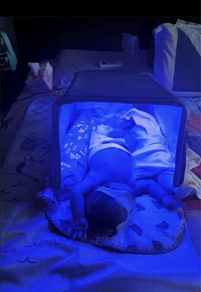 Фотолампа от желтушки (кювез) для новорожденных Аренда