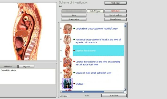 Bioplasm NLS 2 In 1 Bioresonance Machine  софтуер на български