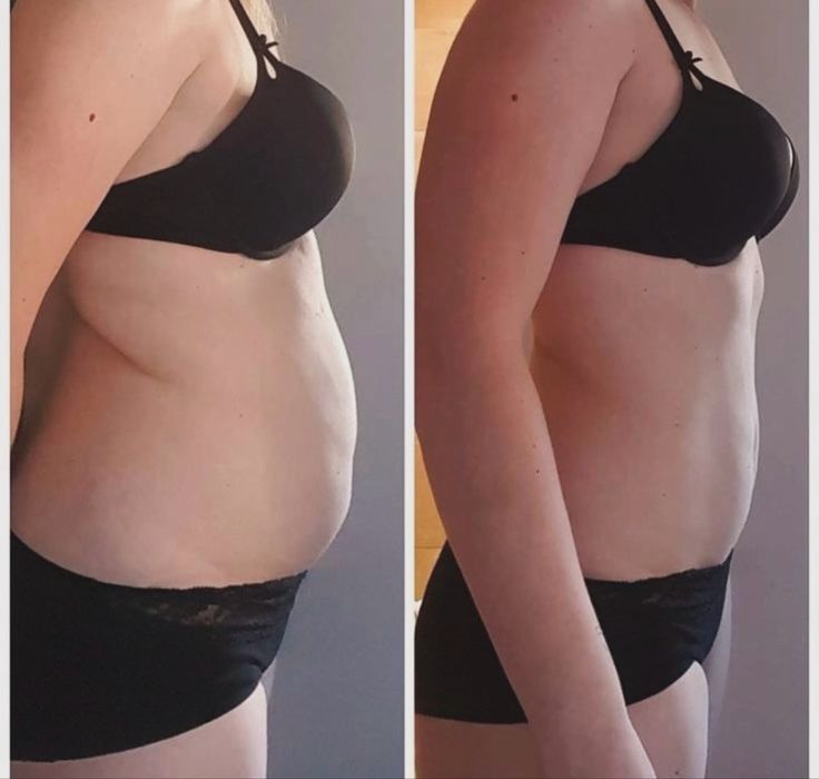 Masaj pentru pierderea în greutate