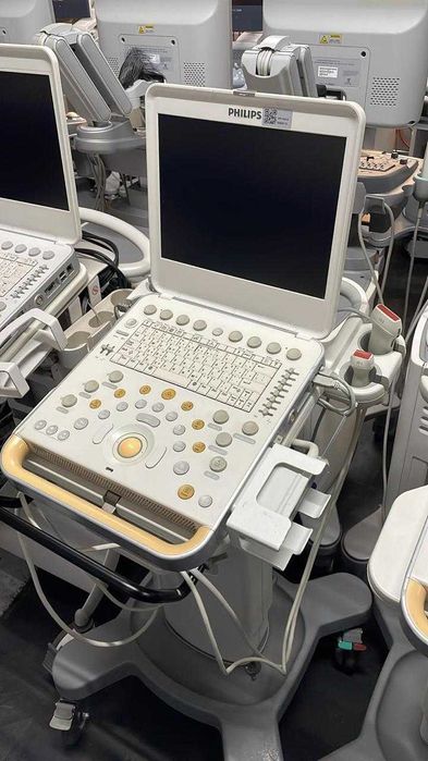 УЗИ Philips CX50 ультразвуковой аппарат УЗИ