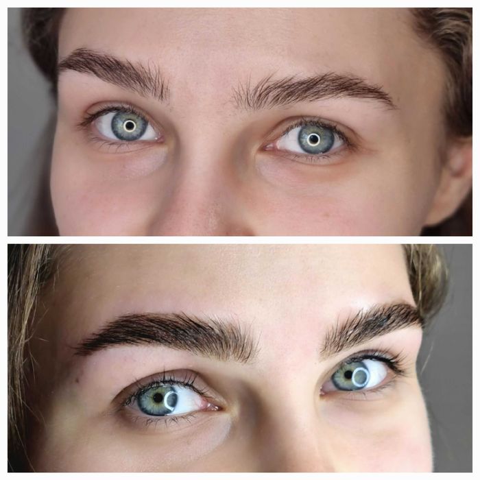 Laminare gene zona Crangasi