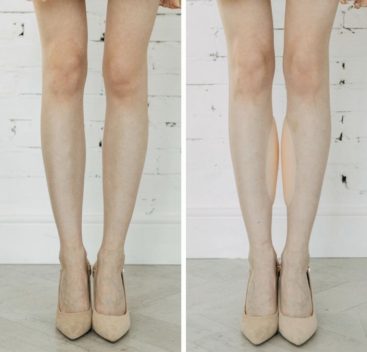 Силиконовые накладки для ног Турция