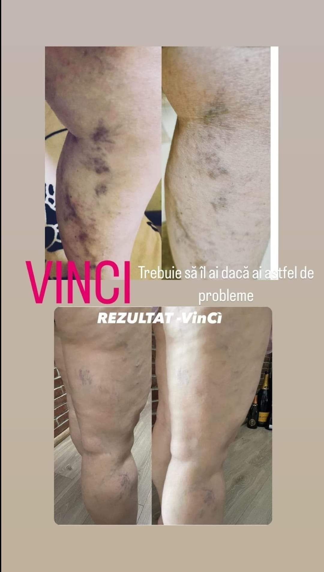 Vinci,ajutorul picioarelor tale