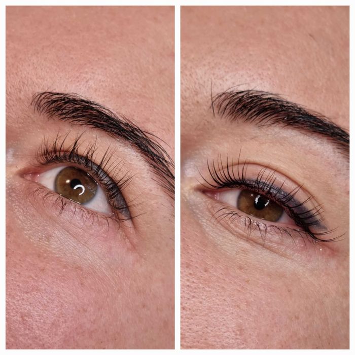 Laminare gene zona Crangasi