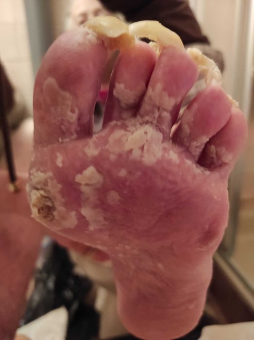 Медицински педикюр по домовете