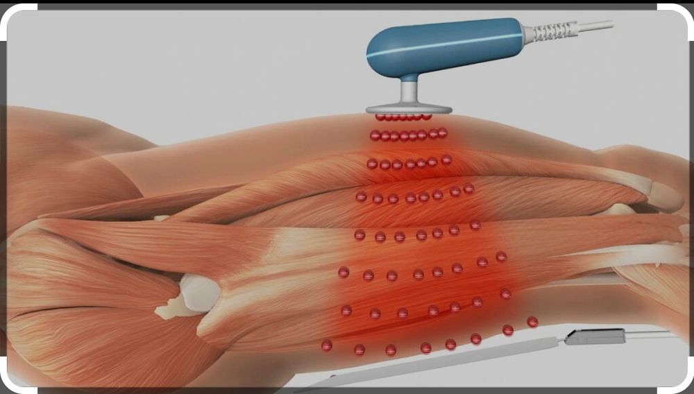 Емдік массаж. Простата массажын жасаймын
