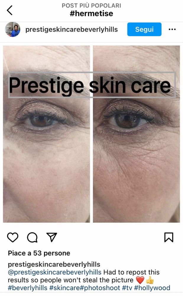 Box Anti-Age Hermetise Professional