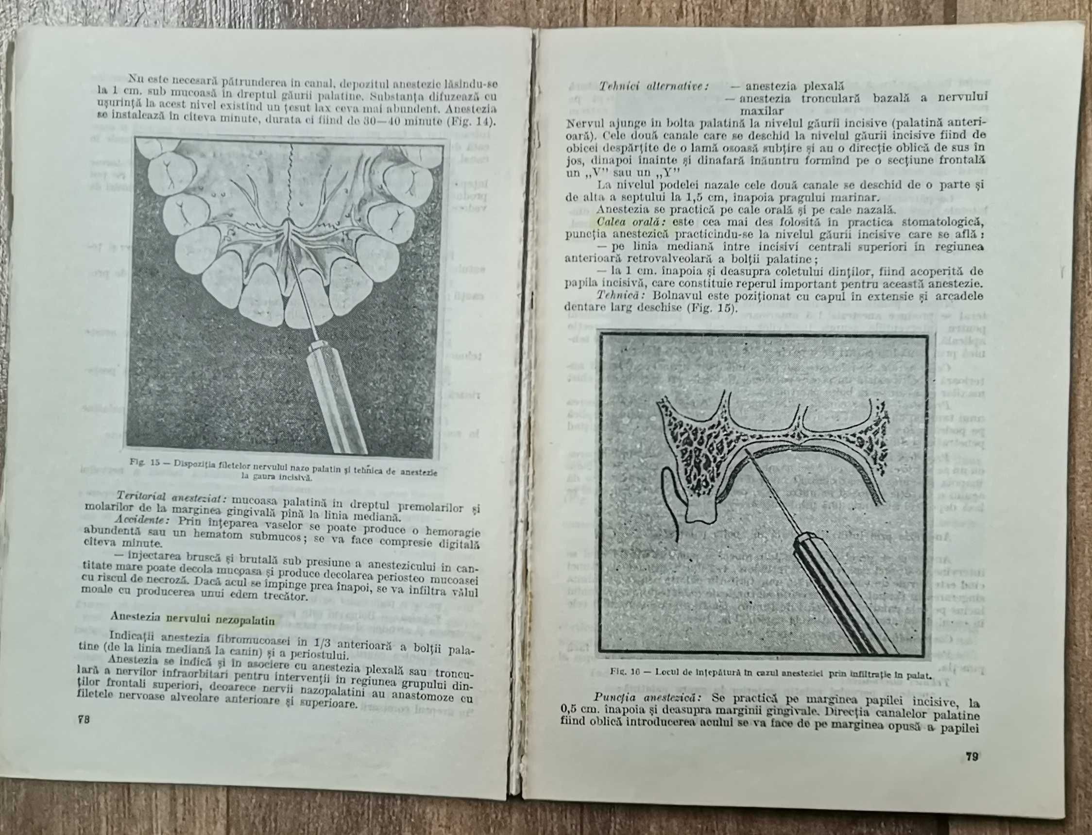 Stomatologie Lot 5 carti manuale medicina anestezie parodontologie