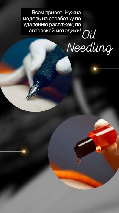 Удаление растяжек по авторской методике