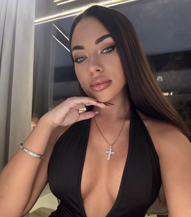 Volum, forma , contur buze pline si frumos conturate cu acid