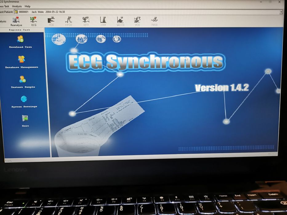 ЕКГ Апарат 12 канала Contec E90A с софтуер за компютър