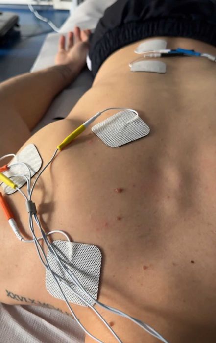 Kinetoterapie & Recuperare | Dry Needling, Tecar, Masaj Terapeutic