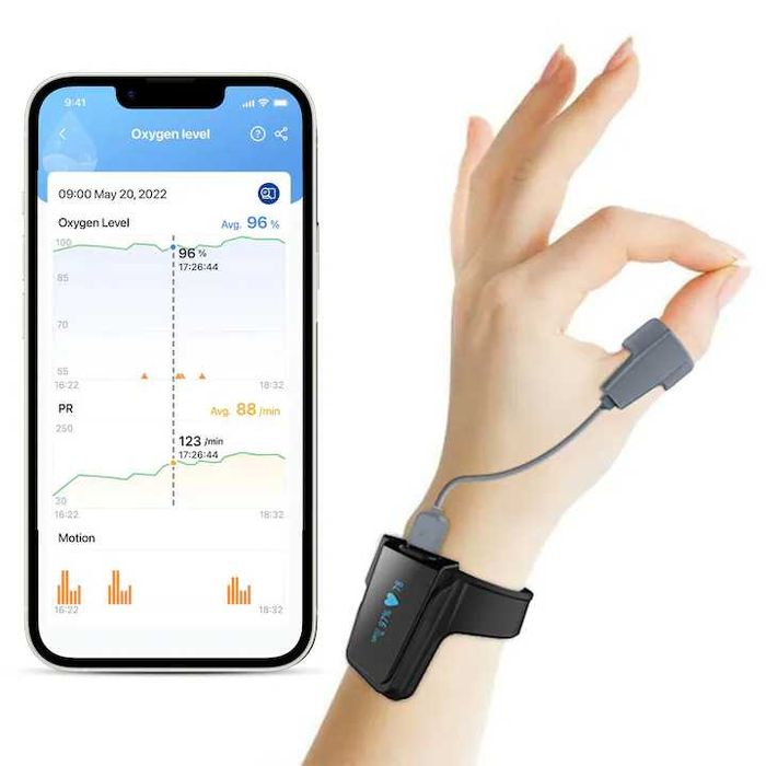 Pulsoximetru Viatom Checkme O2 Max