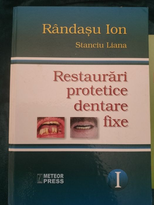 Carte stomatologie  Restaurări protetice dentare fixe Rândașu Ion