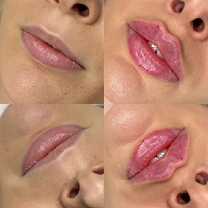 Lab shaklini to'g'rilash va kattalashtirish