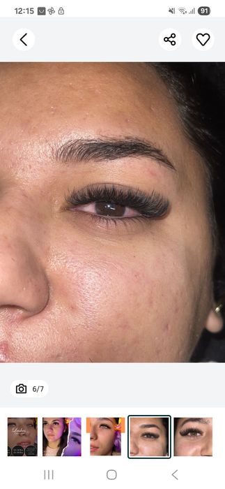 Extensii gene de la 2D până la Soft Volume