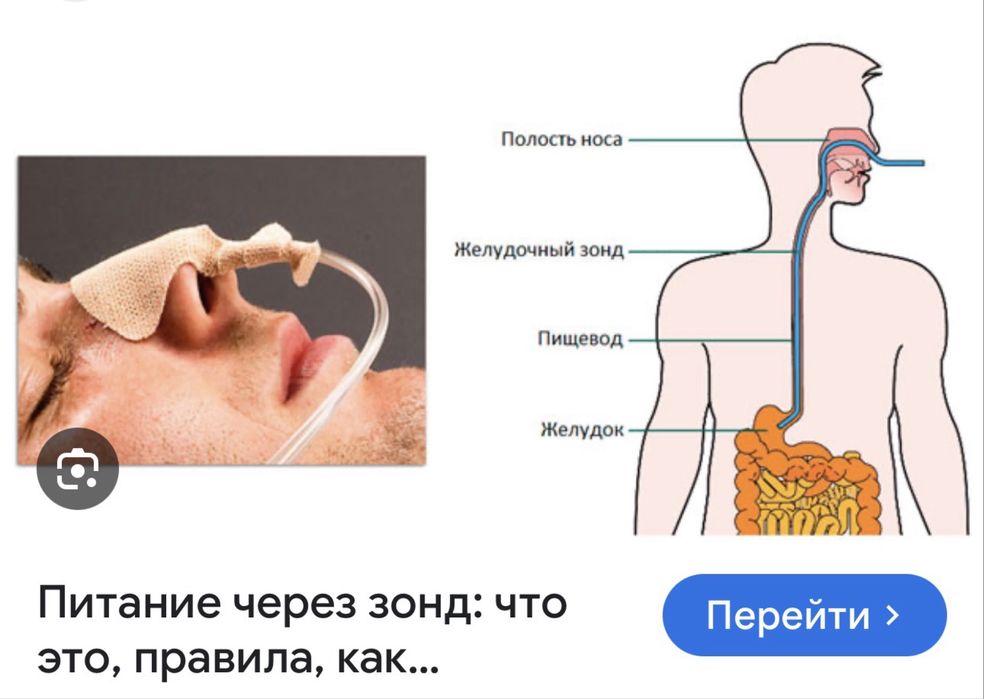 Установим центральный венозный катетер. Markaziy vena kateteri qo'yish