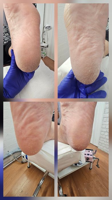 Pedichiură clasică Oradea