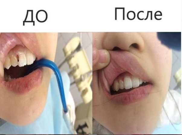 Опытный стоматолог г. Алматы