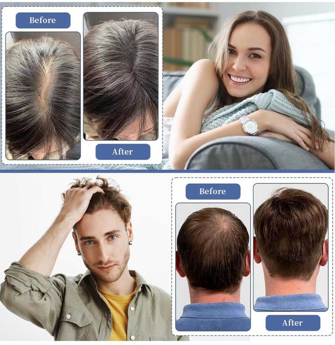 laserLocks Lasercomb-002 нов модел лазерен гребен за растеж на коса