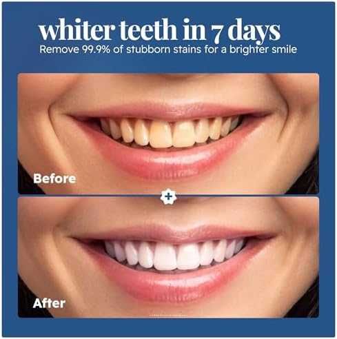 Нов Натурален избелващ прах за зъби – премахва петна от кафе и вино